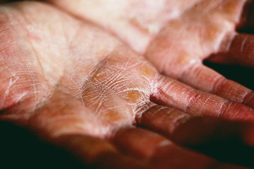 Expert Tips, Tricks, and Benefits! Stay Hydrated during Fasting